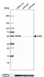 Western blot analysis in Caco-2 cells transfected with control siRNA, target specific siRNA probe #1 and #2, using Anti-HARS antibody. Remaining relative intensity is presented. Loading control: Anti-GAPDH.