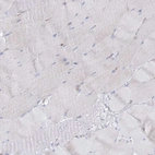 Immunohistochemical staining of human skeletal muscle shows low expression as expected.
