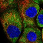 Immunofluorescent staining of human cell line A-431 shows localization to cytosol.