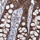 Immunohistochemical staining of human colon using Anti-HIBCH antibody HPA036541.