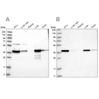 Western blot analysis using Anti-HIBCH antibody HPA036541 (A) shows similar pattern to independent antibody HPA036540 (B).