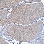 Anti-CUEDC2 Antibody