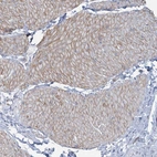 Anti-CUEDC2 Antibody