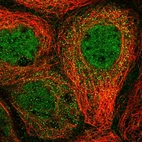 Immunofluorescent staining of human cell line A-431 shows localization to nucleoplasm & cytosol.