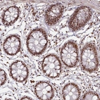 Immunohistochemical staining of human colon shows strong nuclear positivity in glandular cells.