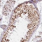 Immunohistochemical staining of human testis shows strong nuclear positivity in cells in seminiferous ducts.
