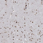 Immunohistochemical staining of human cerebral cortex shows strong nuclear positivity in neurons.