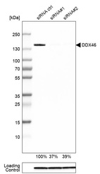 Anti-DDX46 Antibody