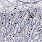 Anti-CFAP58 Antibody