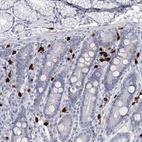 Anti-CFAP58 Antibody