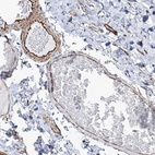 Anti-SCLT1 Antibody