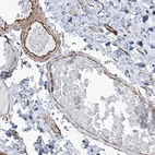 Anti-SCLT1 Antibody