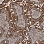 Anti-SCLT1 Antibody