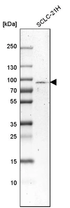 Western blot analysis in human cell line SCLC-21H.