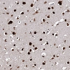 Anti-MATR3 Antibody