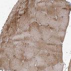 Immunohistochemical staining of human skeletal muscle shows moderate cytoplasmic positivity in myocytes.