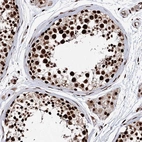 Immunohistochemical staining of human testis shows strong nuclear positivity in cells in seminiferous ducts.