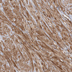 Immunohistochemical staining of human prostate shows strong cytoplasmic positivity in smooth muscle cells.