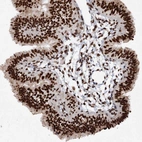 Immunohistochemical staining of human fallopian tube shows strong nuclear positivity in glandular cells.