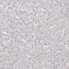 Immunohistochemical staining of human liver shows no positivity in hepatocytes as expected.
