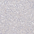 Immunohistochemical staining of human liver shows no positivity in hepatocytes as expected.
