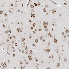 Immunohistochemical staining of human Cerebral cortex shows strong cytoplasmic positivity in neuronal cells.