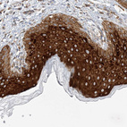 Immunohistochemical staining of human Skin shows strong cytoplasmic positivity in squamous epithelial cells.