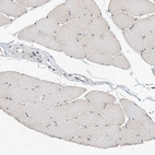 Immunohistochemical staining of human Skeletal muscle shows very weak cytoplasmic positivity in myocytes.