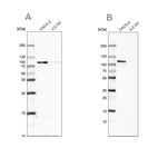 Western blot analysis using Anti-LARP4B antibody HPA036566 (A) shows similar pattern to independent antibody HPA042738 (B).