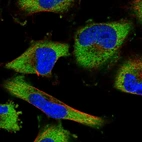 Immunofluorescent staining of human cell line U-251 MG shows localization to cytosol.