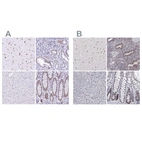 Anti-HNRNPA0 Antibody