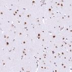 Immunohistochemical staining of human cerebral cortex shows strong nuclear positivity in neurons.