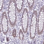 Immunohistochemical staining of human colon shows moderate nuclear positivity in glandular cells.