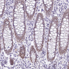 Anti-HNRNPA0 Antibody