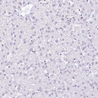 Immunohistochemical staining of human liver shows no nuclear positivity in hepatocytes as expected.