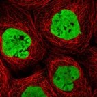 Immunofluorescent staining of human cell line A-431 shows localization to nucleoplasm.