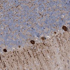 Anti-CMBL Antibody