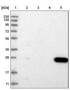 Lane 1: Marker [kDa] 230, 130, 95, 72, 56, 36, 28, 17, 11_br/_Lane 2: Human cell line RT-4_br/_Lane 3: Human cell line U-251MG sp_br/_Lane 4: Human plasma (IgG/HSA depleted)_br/_Lane 5: Human liver tissue