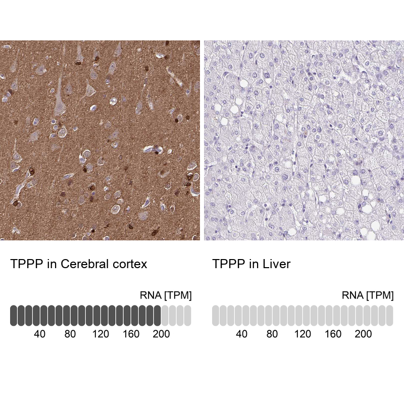 Anti-TPPP Antibody