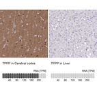 Anti-TPPP Antibody