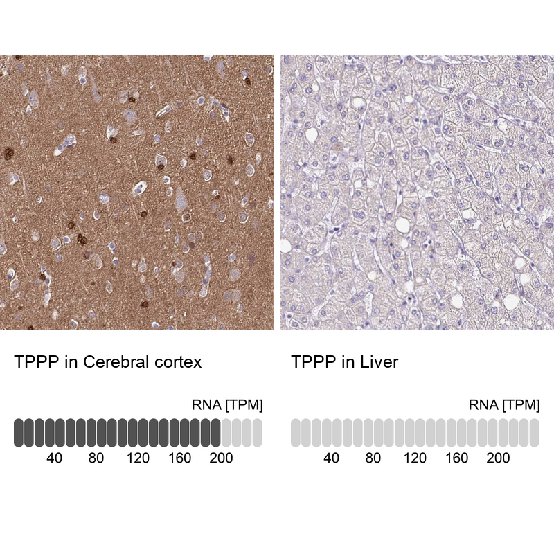 Anti-TPPP Antibody