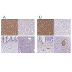 Immunohistochemical staining of human cerebral cortex, liver, lower gastrointestinal and pancreas using Anti-TPPP antibody HPA036576 (A) shows similar protein distribution across tissues to independent antibody HPA036575 (B).