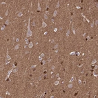 Immunohistochemical staining of human cerebral cortex shows strong cytoplasmic and nuclear positivity in glial cells.