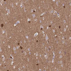 Immunohistochemical staining of human cerebral cortex shows strong cytoplasmic and nuclear positivity in glial cells.