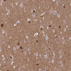Immunohistochemical staining of human cerebral cortex shows strong cytoplasmic and nuclear positivity in glial cells.