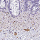 Immunohistochemical staining of human lower gastrointestinal shows moderate cytoplasmic positivity in peripheral ganglion.