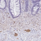 Immunohistochemical staining of human lower gastrointestinal shows moderate cytoplasmic positivity in peripheral ganglion.