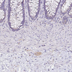 Immunohistochemical staining of human lower gastrointestinal shows weak cytoplasmic positivity in peripheral ganglion.