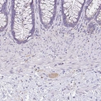 Immunohistochemical staining of human lower gastrointestinal shows weak cytoplasmic positivity in peripheral ganglion.