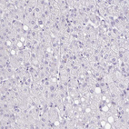 Immunohistochemical staining of human liver shows no positivity in hepatocytes as expected.
